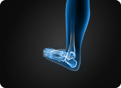 אביזרים נלווים