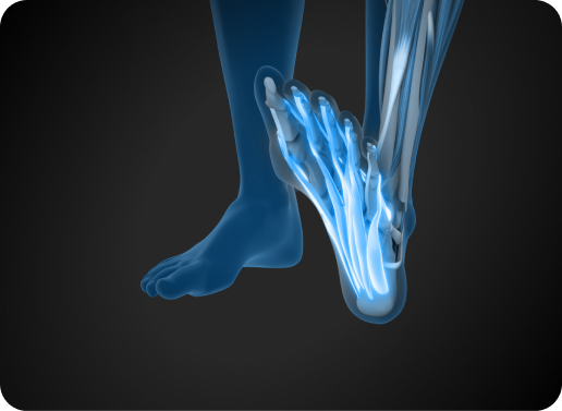 מוצרי דיקטוס